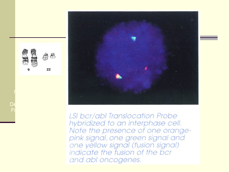 Wysis katalog 1996/97 Fuzovaný gen brc/abl Detekce metodou FISH v interfázní buňce